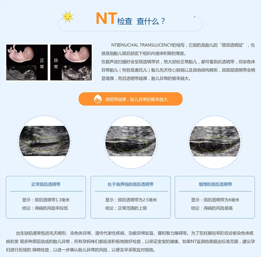 Nt检查是什么 Nt检查多少钱 嘉兴悦程妇产医院手机商城 嘉兴悦程妇产医院